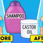 10 Beauty Problems That Castor Oil Can Help You Solve_5e0b7677ce096.jpeg