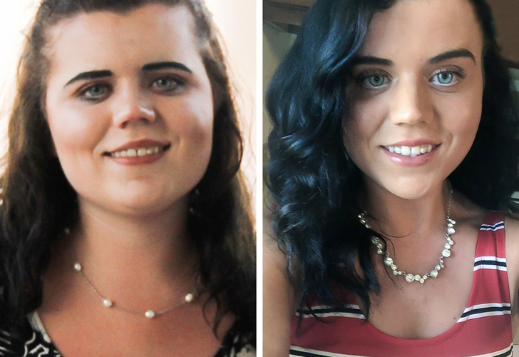 16 People Shared Photos That Split Their Lives Into “Before” and “After”