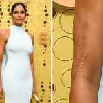10 Celebrities Whose Imperfections Are Hardly Noticeable by Anyone_5e138023a2acc.jpeg