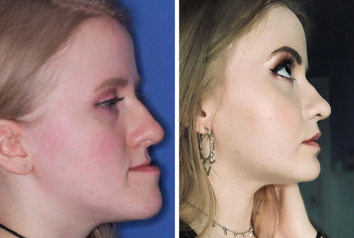 20 Photos That Show What True Change Looks Like