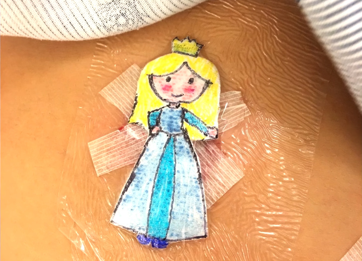 A Surgeon Turns Kids’ Scars Into Cartoon Characters to Help Them Forget About the Pain
