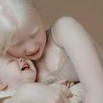 Albino Sisters Born 12 Years Apart Excite the Internet With Their Photos_5e2b55479fc68.jpeg