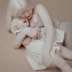 Albino Sisters Born 12 Years Apart Excite the Internet With Their Photos_5e2b5550384f2.jpeg