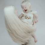 Albino Sisters Born 12 Years Apart Excite the Internet With Their Photos_5e2b5554ca799.jpeg