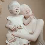Albino Sisters Born 12 Years Apart Excite the Internet With Their Photos_5e2b555645add.jpeg