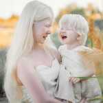 Albino Sisters Born 12 Years Apart Excite the Internet With Their Photos_5e2b5557a677c.jpeg