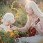 Albino Sisters Born 12 Years Apart Excite the Internet With Their Photos_5e2b556560a2f.jpeg