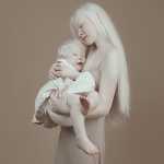 Albino Sisters Born 12 Years Apart Excite the Internet With Their Photos_5e2b556b0e13c.jpeg