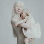 Albino Sisters Born 12 Years Apart Excite the Internet With Their Photos_5e2b55725d520.jpeg