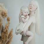 Albino Sisters Born 12 Years Apart Excite the Internet With Their Photos_5e2b55768d185.jpeg