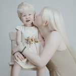Albino Sisters Born 12 Years Apart Excite the Internet With Their Photos_5e2b557806c59.jpeg