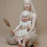 Albino Sisters Born 12 Years Apart Excite the Internet With Their Photos_5e2b5578e11fc.jpeg