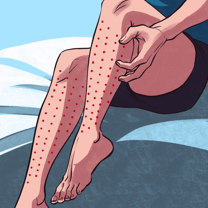 Ways to Check If You Have Restless Legs Syndrome and Why You Need to See a Doctor If You Do